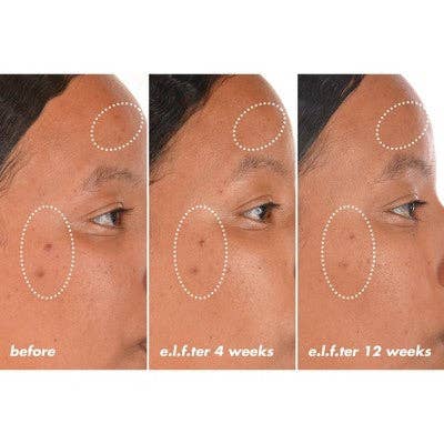 E.l.f. SKIN Bright Icon Vitamin C + E + Ferulic Face Serum 1 fl oz - Imperfect Box