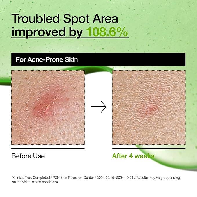 ANUA Azelaic Acid 10 Hyaluron Redness Soothing Serum 30ml/ 1.01 fl oz.