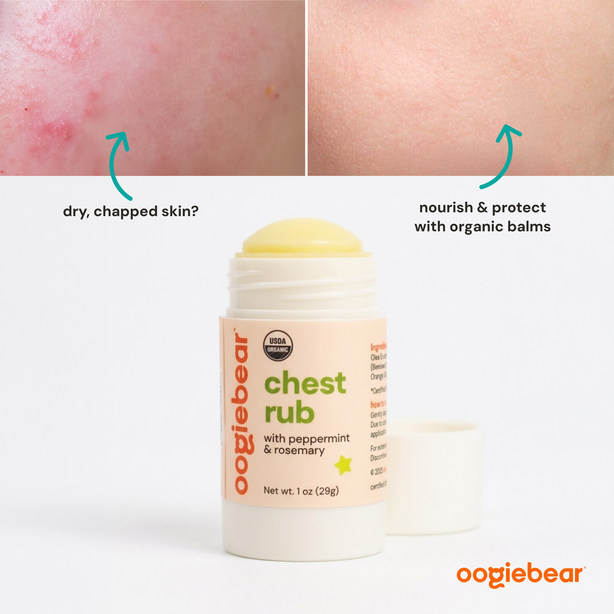 Oogiebear chest rub