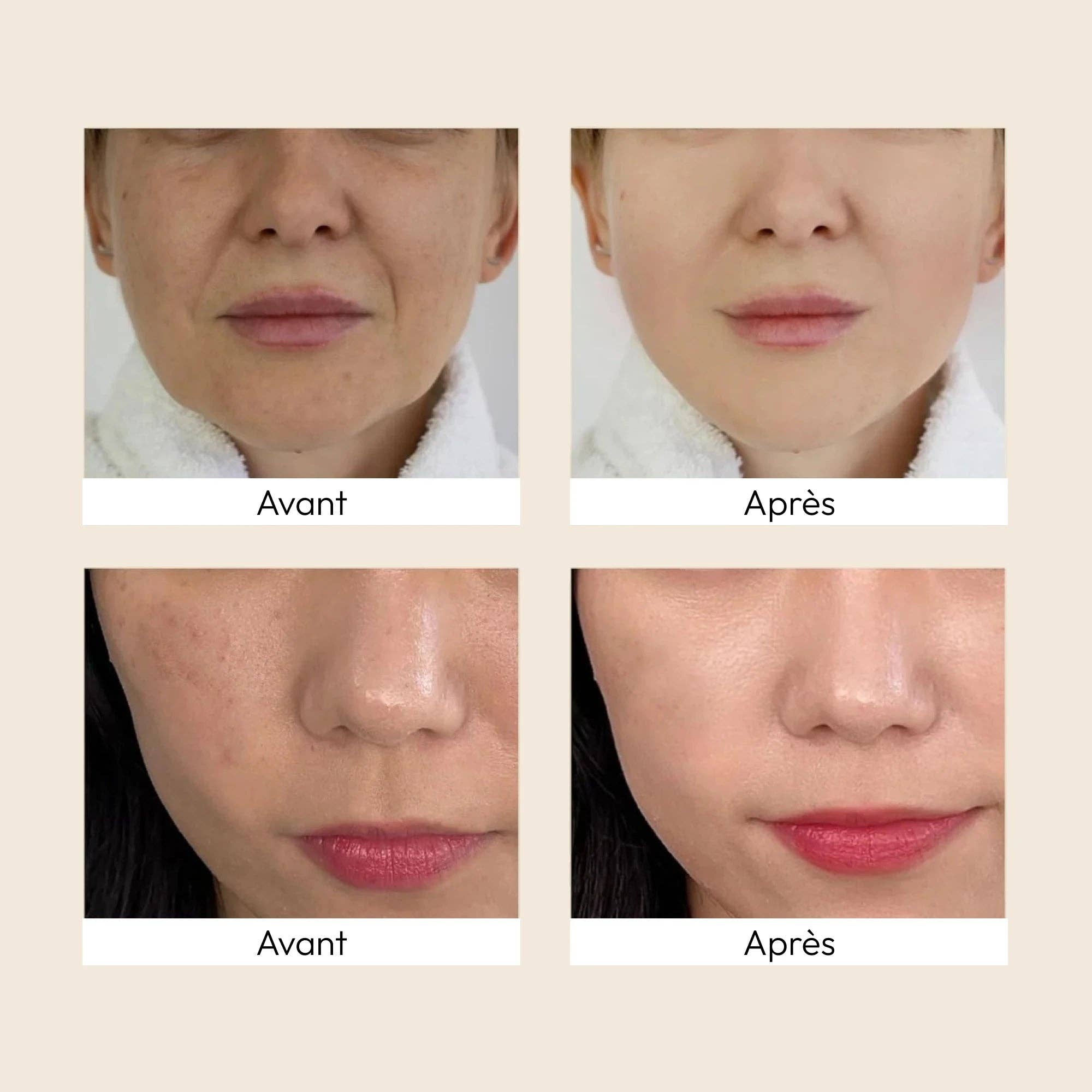 K-SECRET - SEOUL 1988 Essence: Snail Mucin 97% + Rice