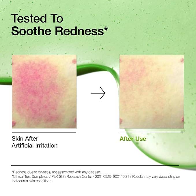 ANUA Azelaic Acid 10 Hyaluron Redness Soothing Serum 30ml/ 1.01 fl oz.